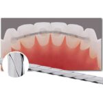 ORTHO TECHNOLOGY Fio de Retenção Entrançado 10x28 - Image 2